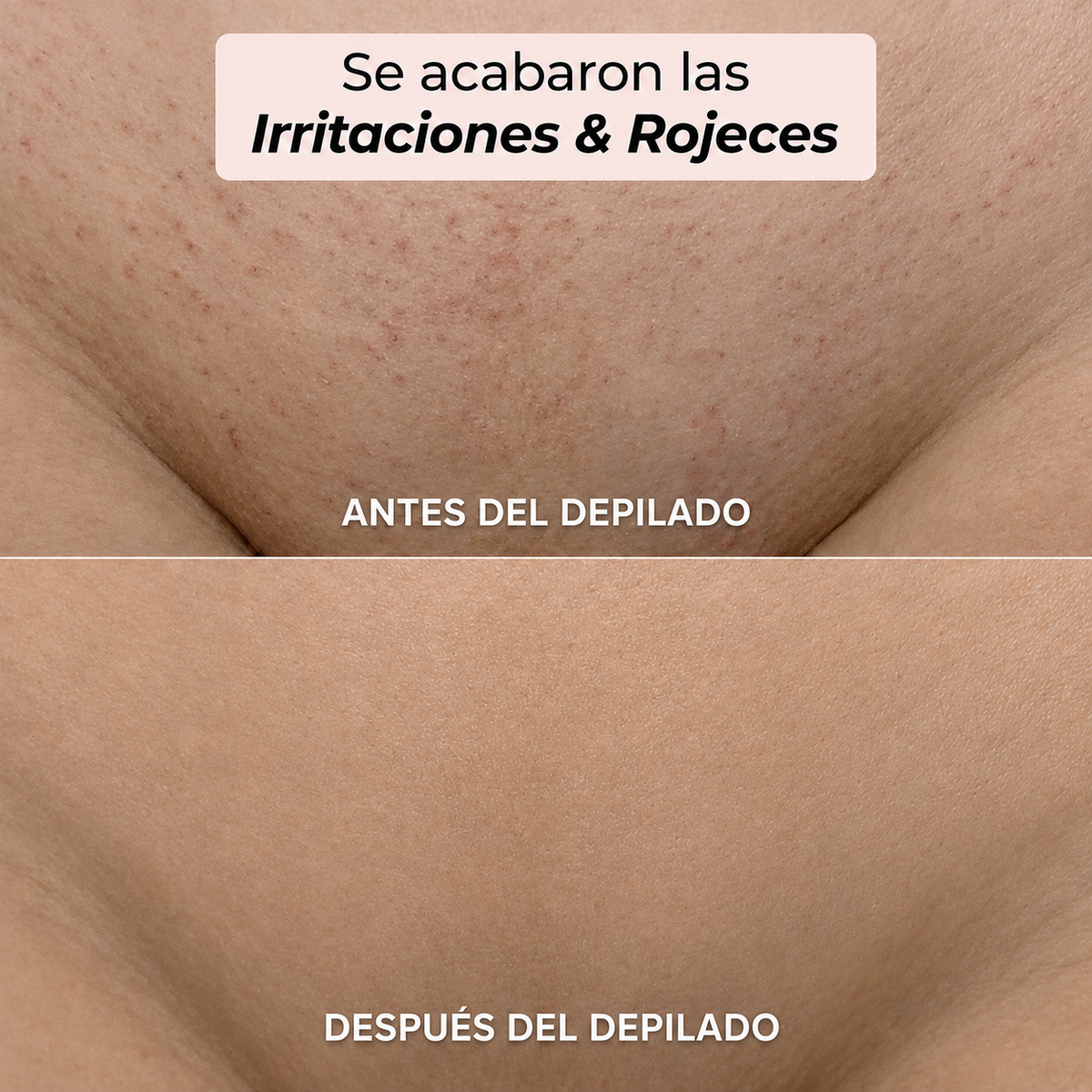Depiladora 2 en 1